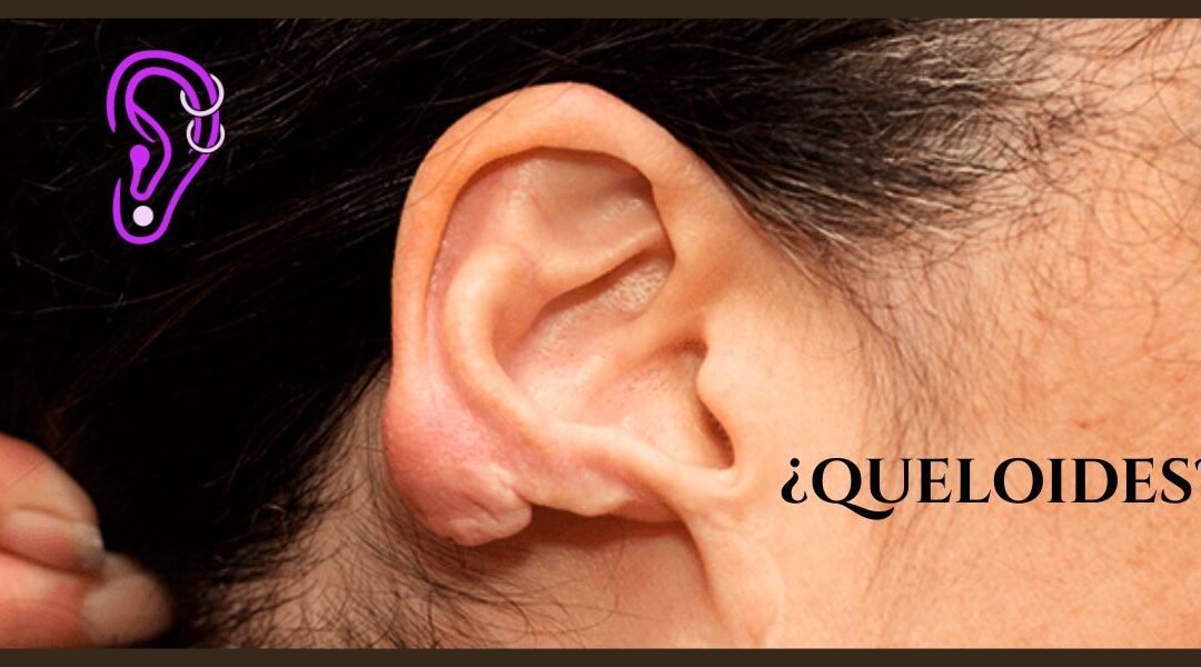 Queloides en la oreja