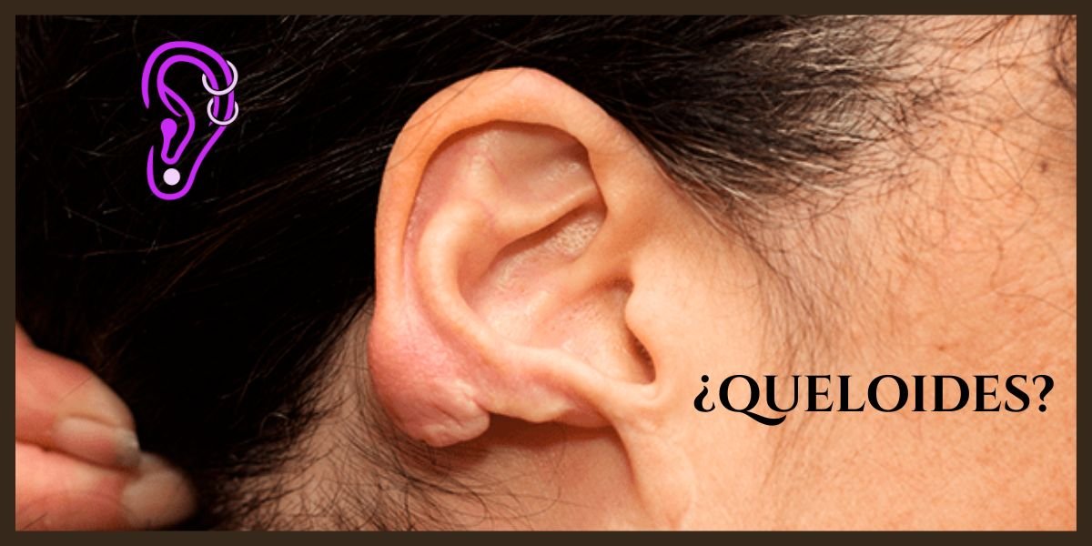 Queloides en la oreja